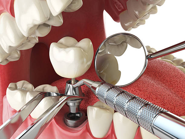 Best Emergency Treatment for Toothache in Edgar, WI